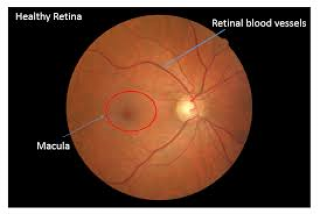Width of Blood Vessels in Retina May Indicate Brain Health